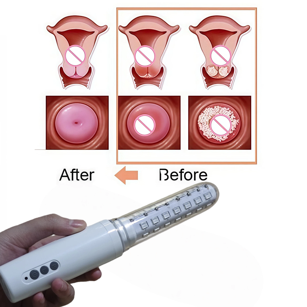 650nm LLLT Cold Laser Wand, Wo – Health Wellness Home Care recenzja i cena